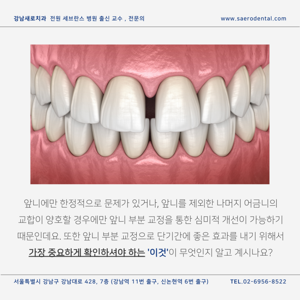 앞니벌어짐, 단기간에 효과 보시려면 관련 이미지 3