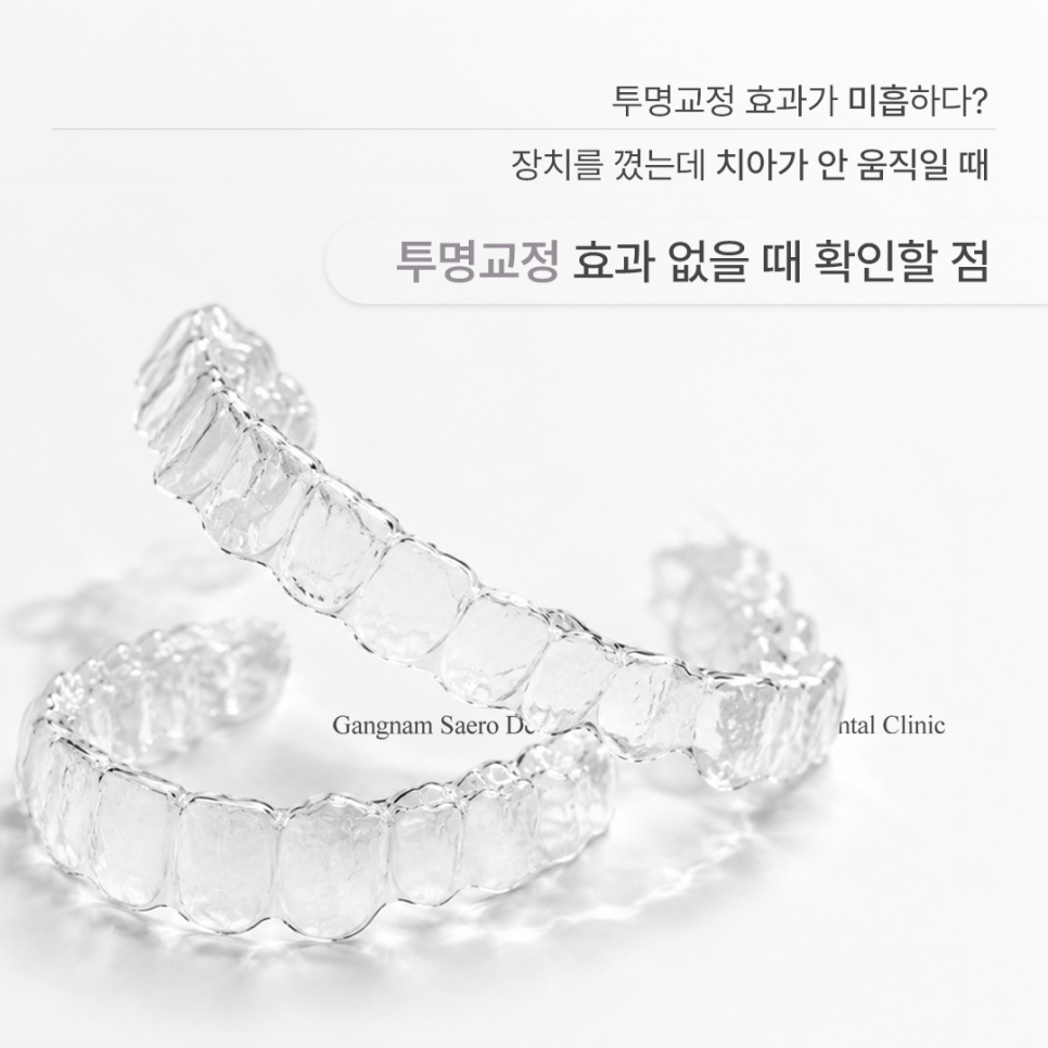 투명교정효과 미흡하다? 장치를 꼈는데 치아가 안 움직일 때 확인할 점 관련 이미지 1