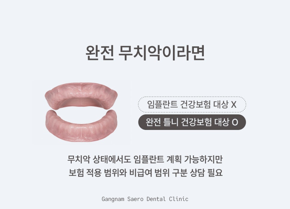 부모님 선물 임플란트 생각하고 있다면 (전체임플란트) 관련 이미지 7