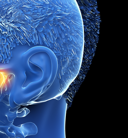 턱관절 탈구가 발생하는 원인과 치료 방법? 관련 이미지 8