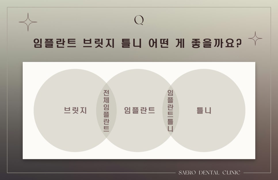 임플란트 알기 어려운 질문 모음 (임플란트 구체적인 Q&A) 관련 이미지 5