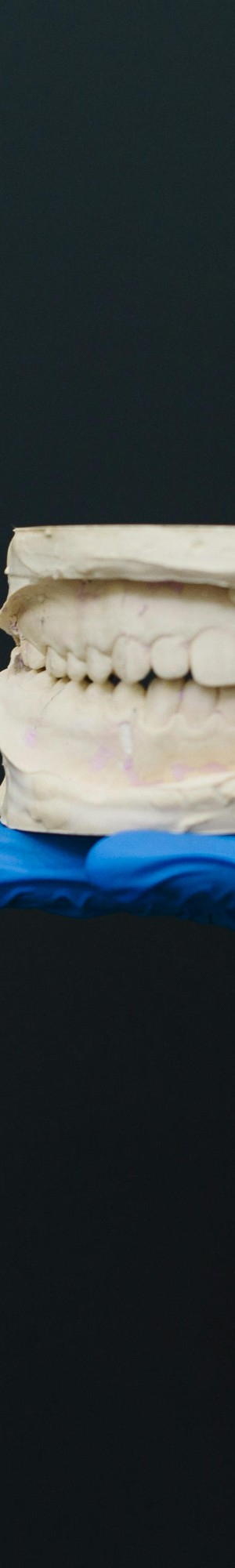 치아 개수와 관련된 질환들, 구강 건강 상식 알아보기. 관련 이미지 8