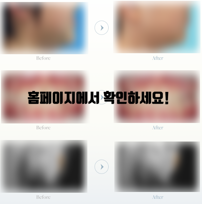 주걱턱은 조기 치료가 핵심 (어린이주걱턱교정) 관련 이미지 5