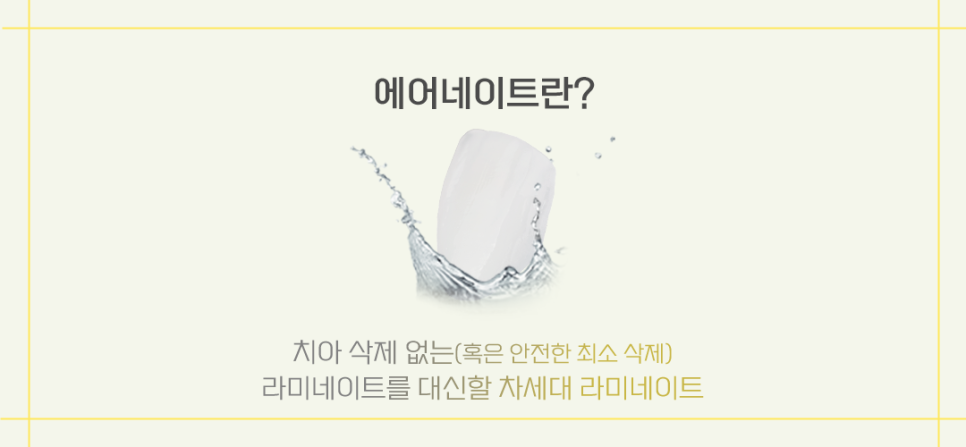 라미네이트 대체 시술 제로라미네이트 (에어네이트) 관련 이미지 2