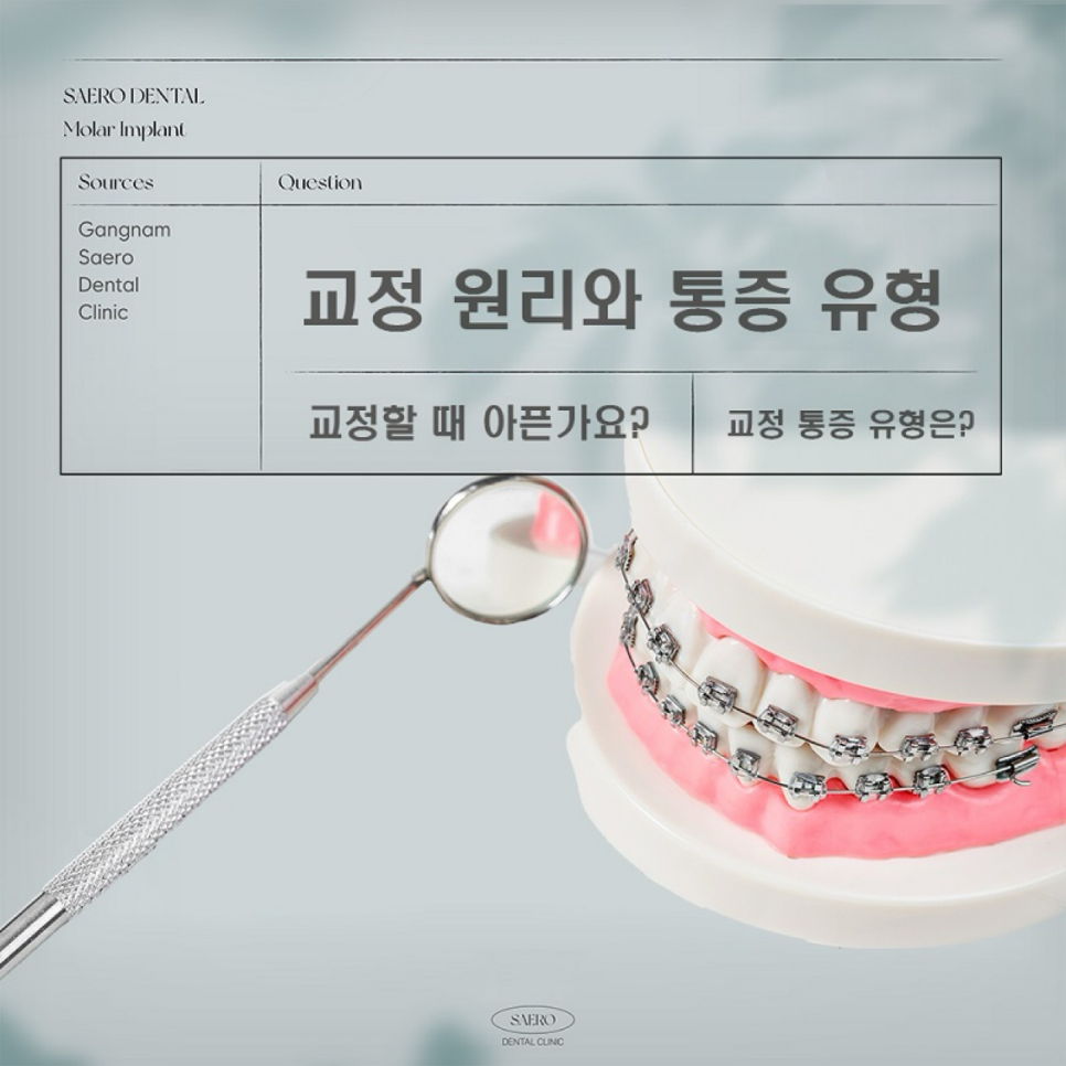 교정 원리와 통증 유형 (교정할 때 아픈가요?) 관련 이미지 1