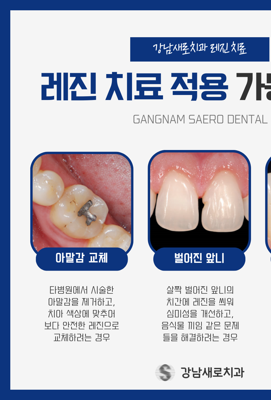 강남역 충치치료, 치아의 문제를 개선하는 과정? 관련 이미지 5