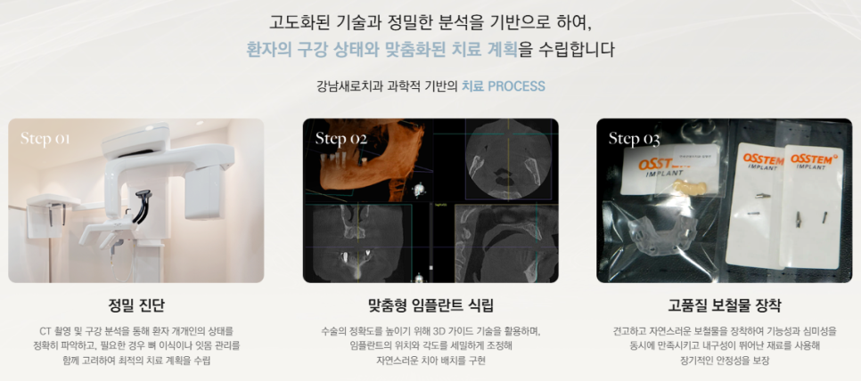 치아가 얼마 안 남은 65세이상임플란트 (전체임플란트후기) 관련 이미지 7