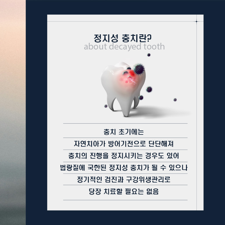 양심치과가 말해주는 모든 충치가 치료해야 하는 건 아니다? (정지성충치) 관련 이미지 4