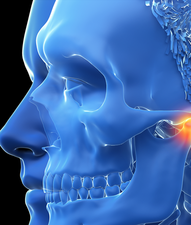 턱관절 탈구가 발생하는 원인과 치료 방법? 관련 이미지 7