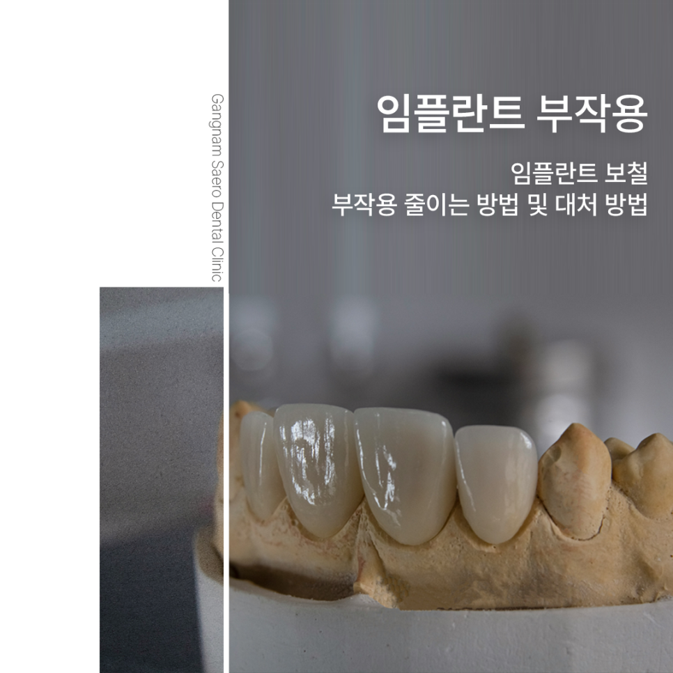 임플란트부작용 보철 (크라운, 지대주, 픽스쳐) 예방 및 대처 방법 관련 이미지 13