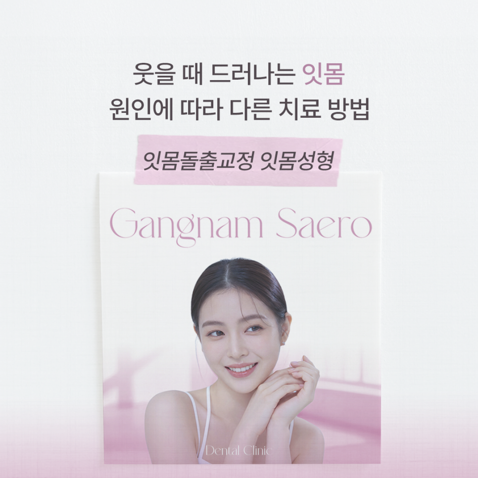 Treatment Methods That Differ Depending on the Cause of Gums Showing When You Smile (Gummy Smile Correction, Gum Contouring) image 1