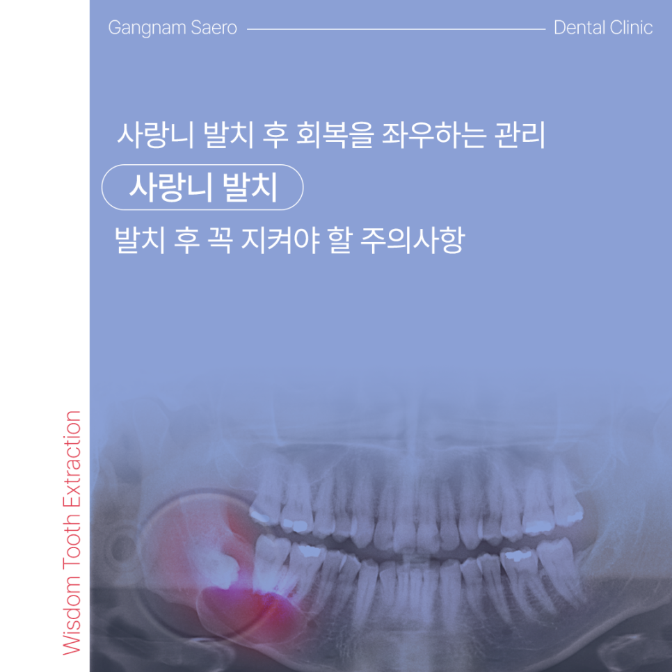 Important Precautions to Follow After Wisdom Tooth Extraction (Wisdom Tooth Extraction) image 1