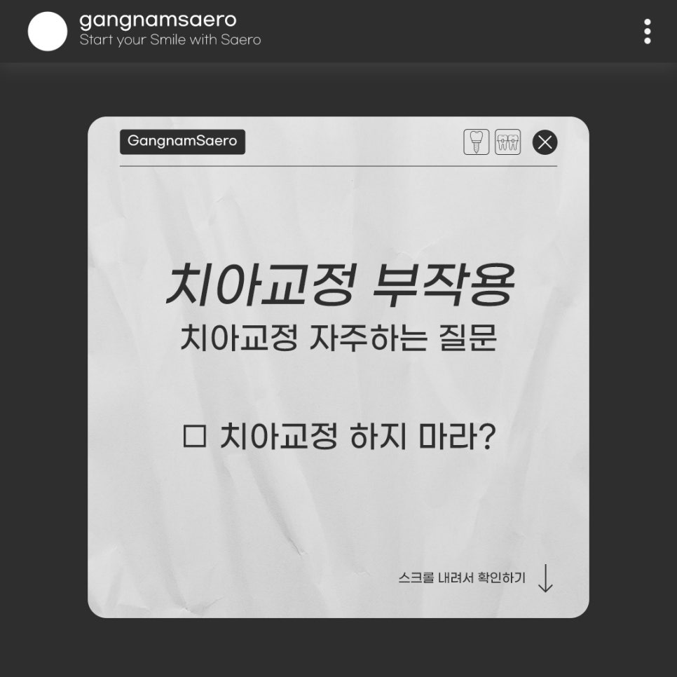 치아교정부작용 때문에 걱정돼요! (치아교정하지마라) 관련 이미지 1