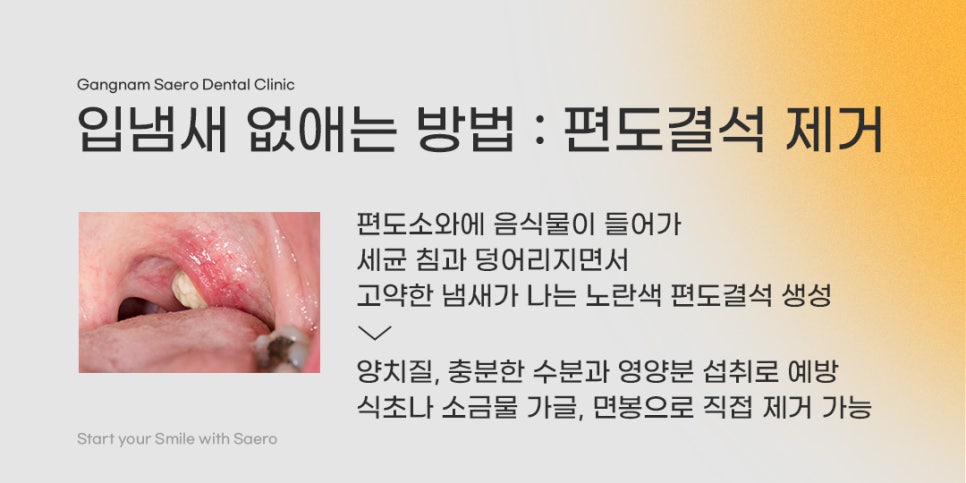 치과에서 말하는 입냄새, 양치만으로 해결 안 되는 이유 (입냄새원인) 관련 이미지 5