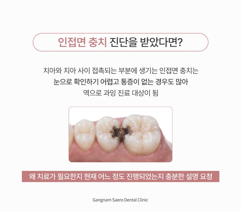 치과과잉진료 종류, 초기충치 인접면충치 충치옮음 시린이 제대로 알고 올바르게 치료하자 관련 이미지 3