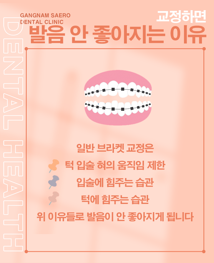 배우 아나운서 치아 컴플렉스 해결 (치아교정발음) 관련 이미지 3