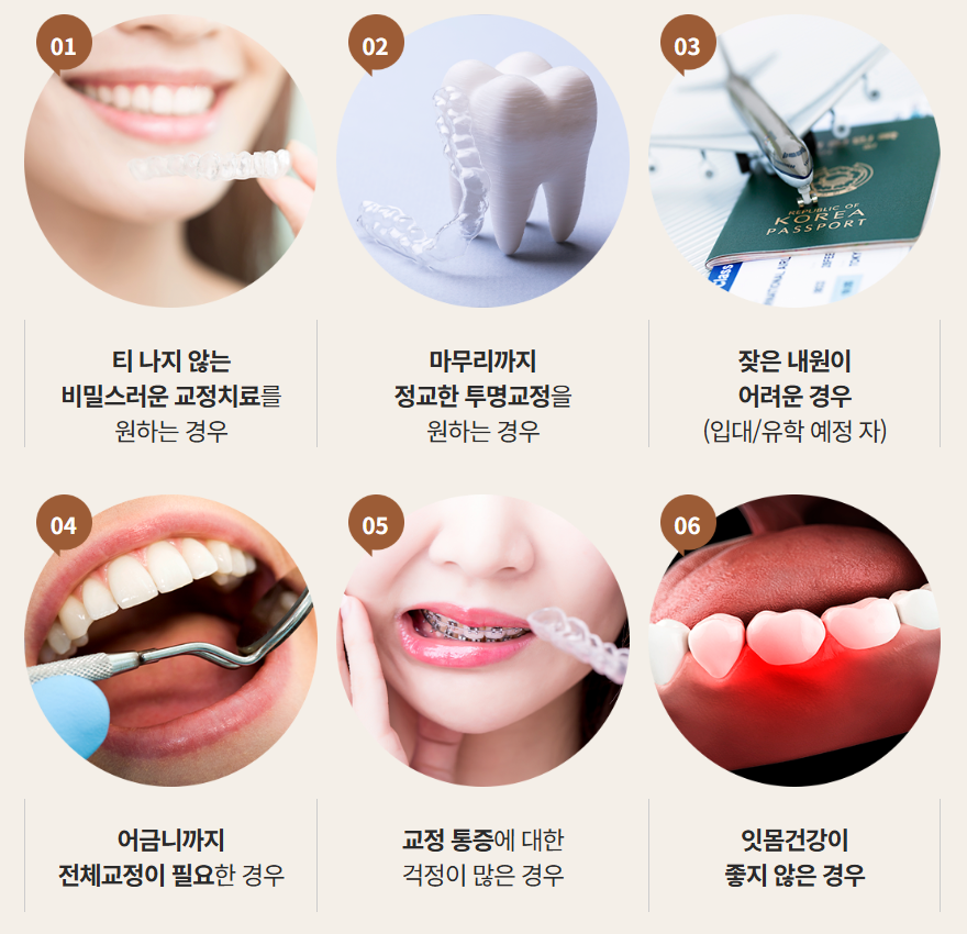 투명교정장치 다시 알아보기 (2) 나노라이너 관련 이미지 1