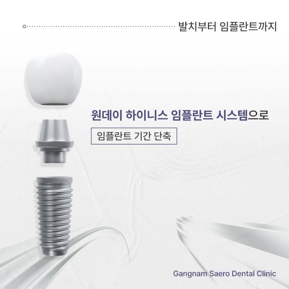Shortening the Implant Treatment Period: From Tooth Extraction to Implant Placement with a One-Day System image 1