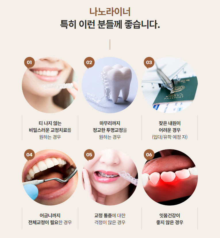 투명교정종류 자세히 알아보기 (2) 나노라이너 관련 이미지 2