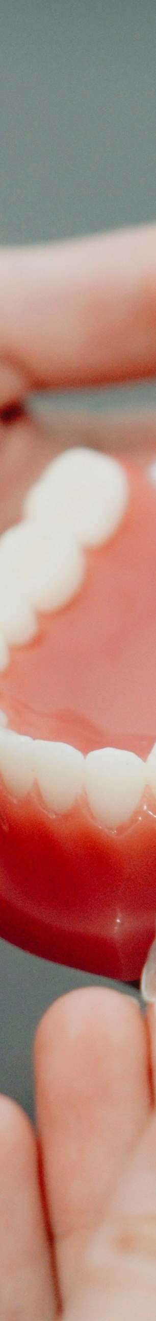 성인치아교정 치료, 부정교합, 구강 건강 개선이 될까요? 고민하고 계시다면 궁금증 타파해드립니다! 관련 이미지 8