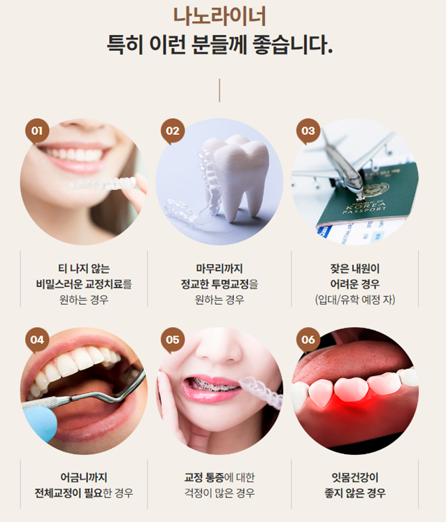 나노라이너란 무엇인가요? (투명교정종류 나노라이너) 관련 이미지 8