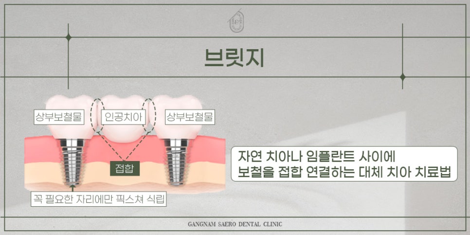 치과 검색어 탐구 관련 이미지 2