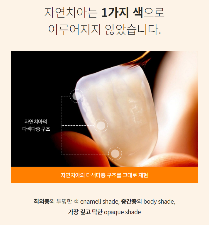 에어네이트의 특별함 (라미네이트 대체 시술) 관련 이미지 5