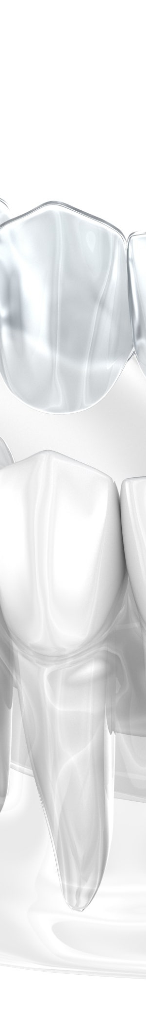 투명 교정 찾고 계신가요? 교정 치료 받기 전 같이 알아보고 갈까요? 관련 이미지 15