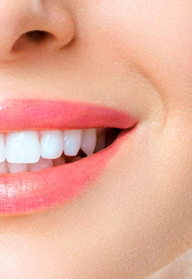 웃을때 잇몸이 많이 보인다면? 해결 방법 관련 이미지 5