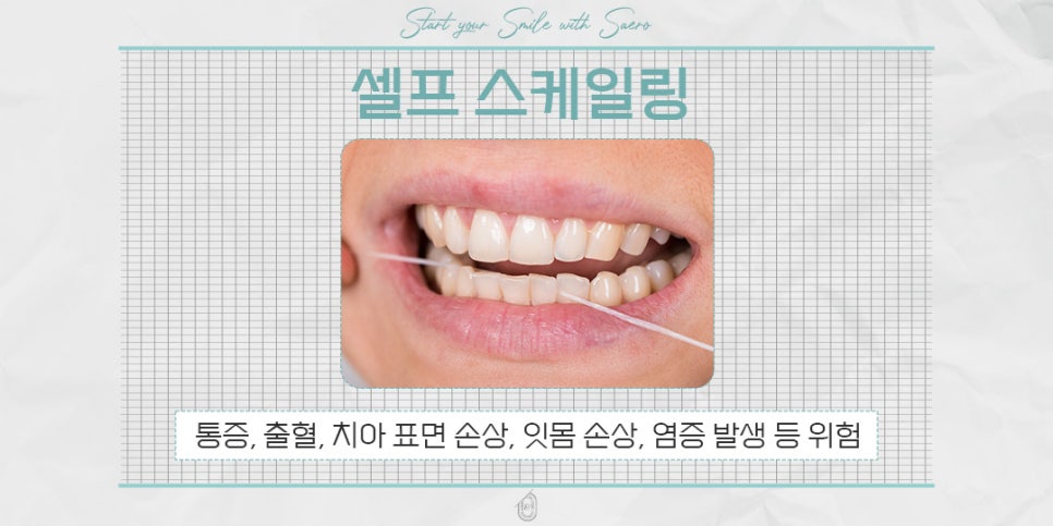 스케일링 시간/비용 강남역스케일링치과 (무통스케일링) 관련 이미지 5