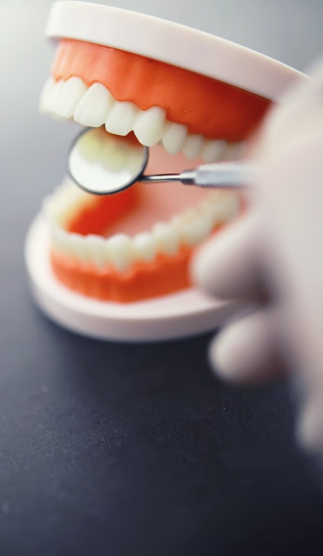 송곳니 덧니교정, 비발치로 안전하게 진행 관련 이미지 4