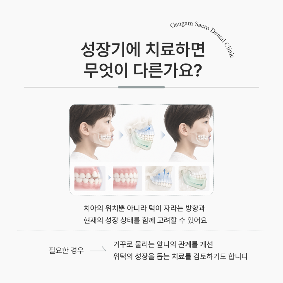 어린이 주걱턱, 영구치가 다 나올 때까지 기다려도 될까요? 관련 이미지 4