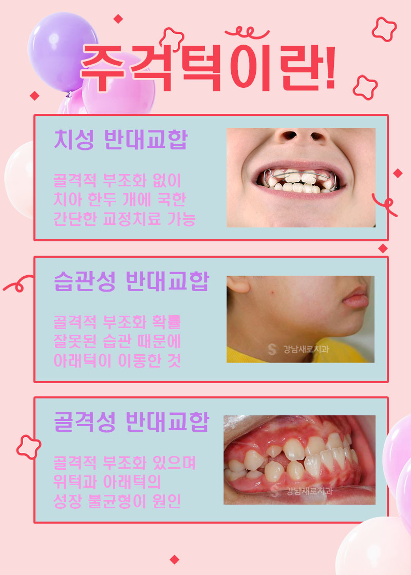 우리아이 주걱턱 수술 없이 해결하려면 (어린이주걱턱교정) 관련 이미지 2