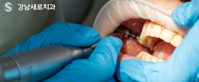 강남역잇몸염증치료, 잇몸피가 나는 원인의 치료방법? 관련 이미지 8