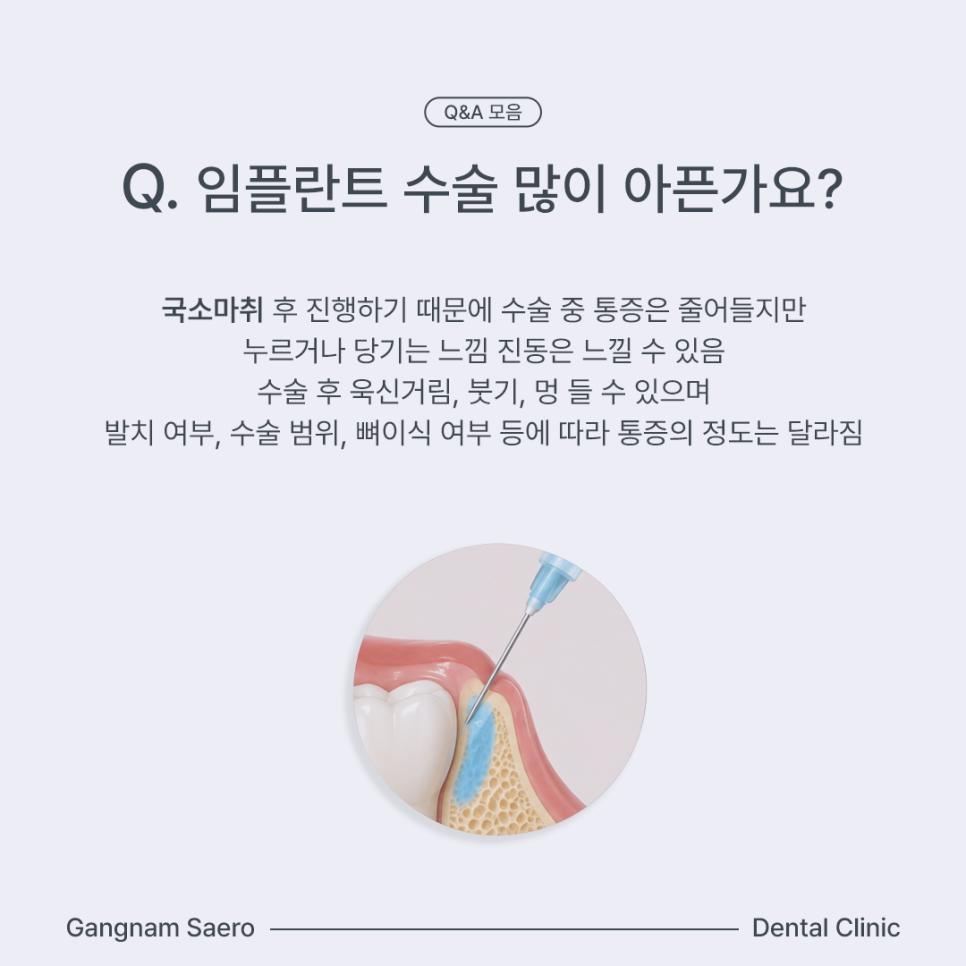 임플란트 자주하는 질문 통증, 기간, 뼈이식 Q&A모음 관련 이미지 2