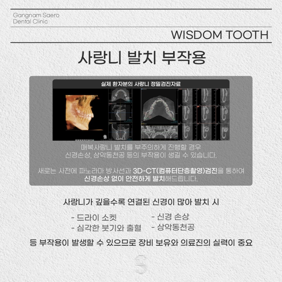 강남역근처치과 사랑니부작용 (사랑니발치) 관련 이미지 3