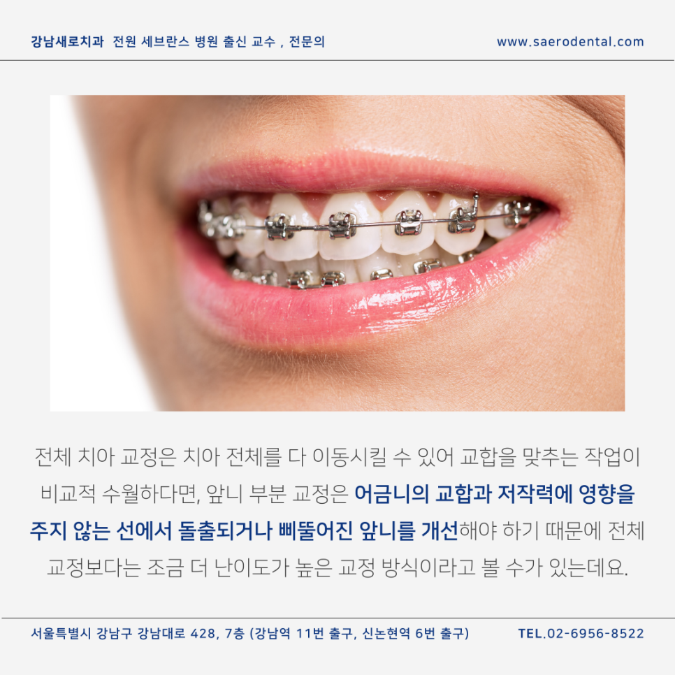 앞니벌어짐, 단기간에 효과 보시려면 관련 이미지 5