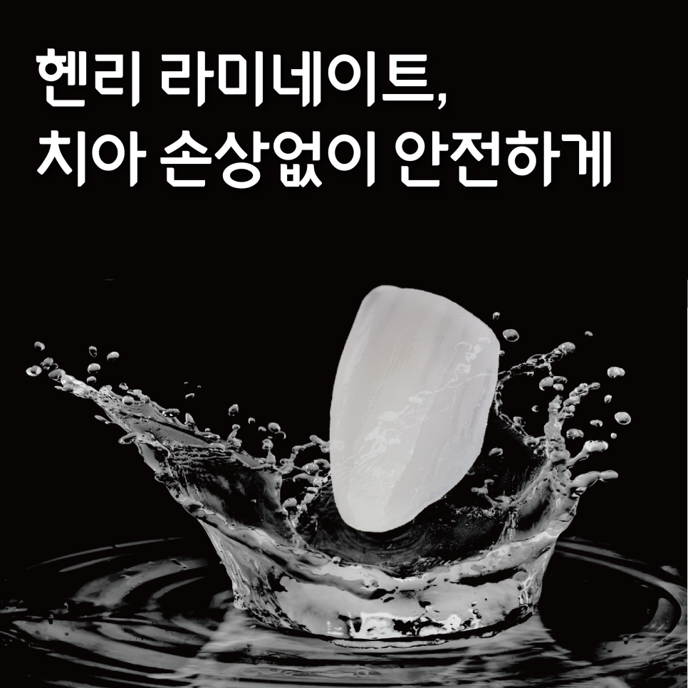 헨리라미네이트, 치아 손상없이 안전하게 진행 관련 이미지 1