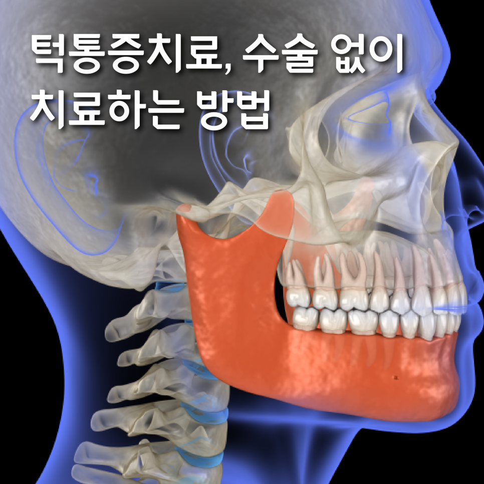 턱통증치료, 근본적 이유를 해결하는 비수술 진료 과정 관련 이미지 1