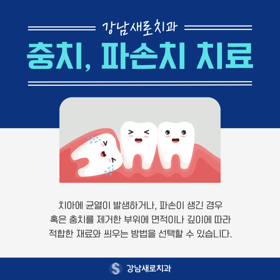 강남충치치료, 상태에 맞는 치료 방법을 선택하려면? 관련 이미지 1