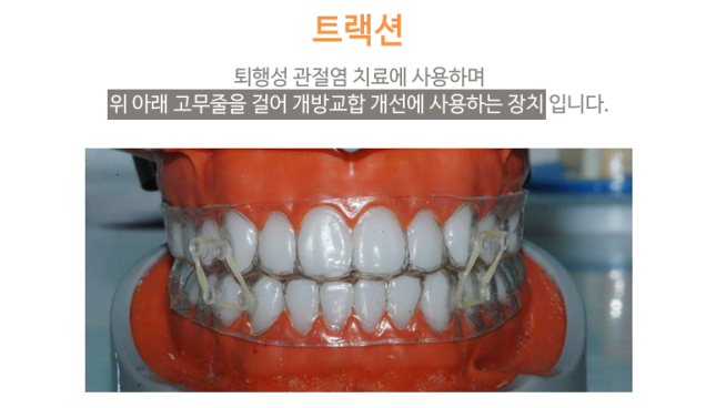 입안다물어짐 비수술로 해결이 가능하다면 관련 이미지 8