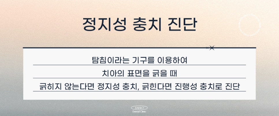 과잉 진료 없이 충치 치료하기 (정지성충치) 관련 이미지 4
