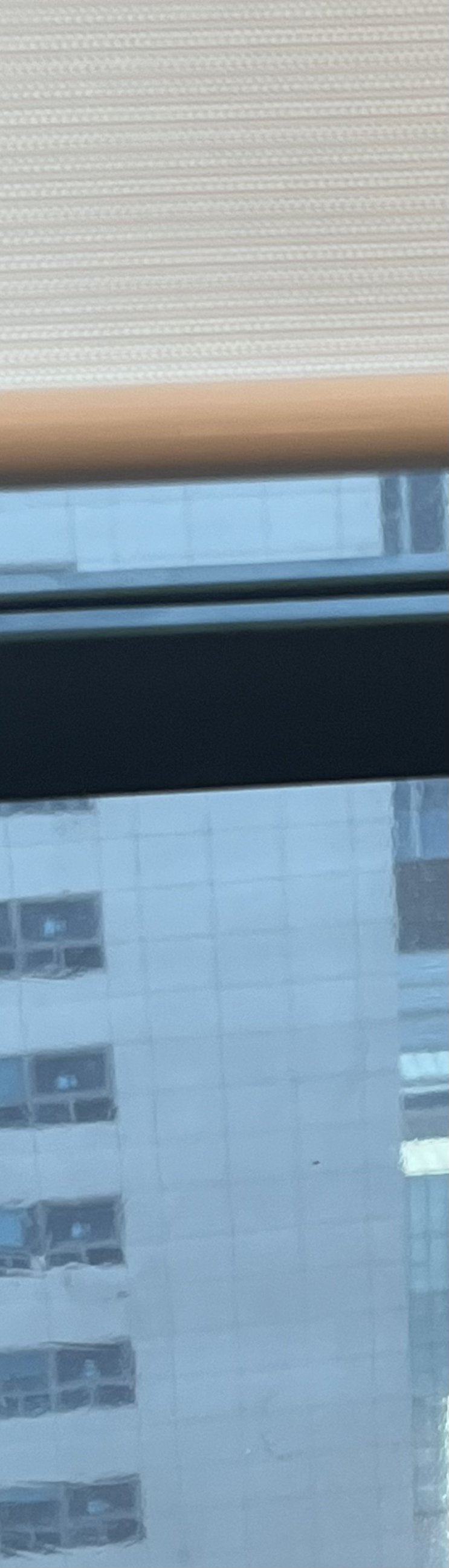 발치 후 교정, 이빨을 뽑지 않는 치료 방법이 있다? 관련 이미지 7