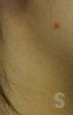 양악전 교정과 양악후 교정, 진행 방법의 차이를 알아보자. 관련 이미지 2