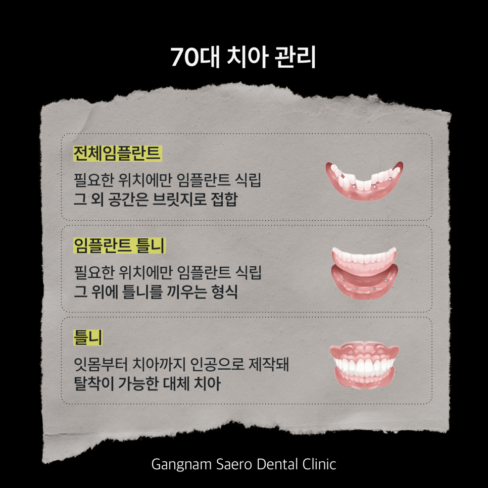 나이 들수록 달라지는 치아 관리 (연령별 치아 대체 치료 종류) 관련 이미지 5