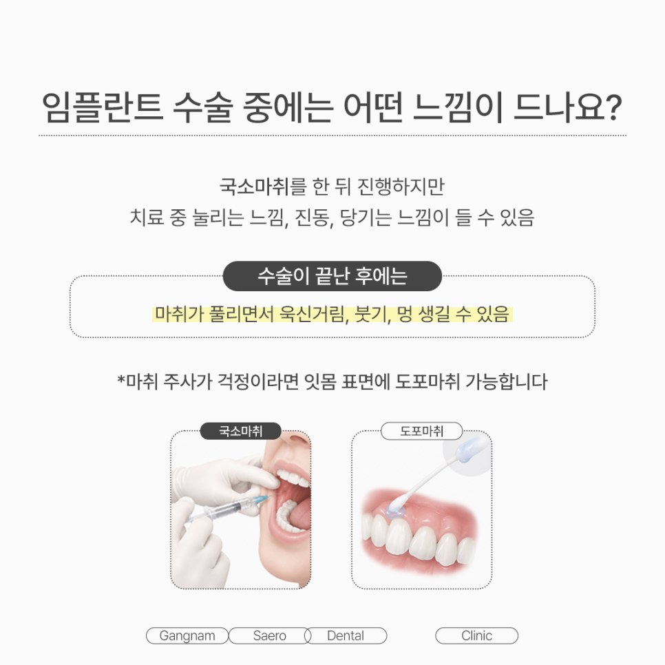 임플란트 많이 아플까요? 수술 전 알아둘 임플란트통증 및 진정치료 관련 이미지 3