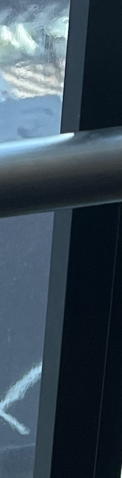 발치 후 교정, 이빨을 뽑지 않는 치료 방법이 있다? 관련 이미지 13