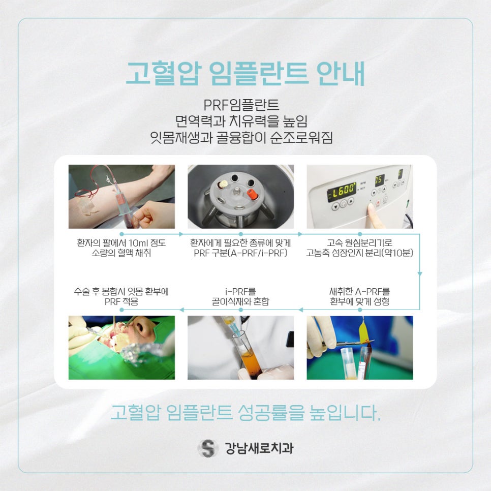 고혈압 증상 및 원인 그리고 임플란트 (고혈압임플란트 PRF임플란트) 관련 이미지 7