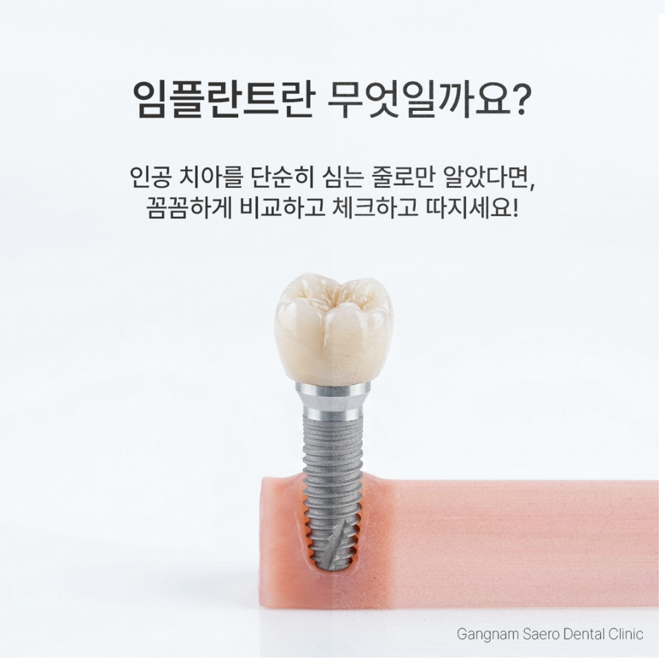 임플란트수술 단순히 심는 줄로만 알았다면 확인해 봐야 할 (임플란트수술) 관련 이미지 11