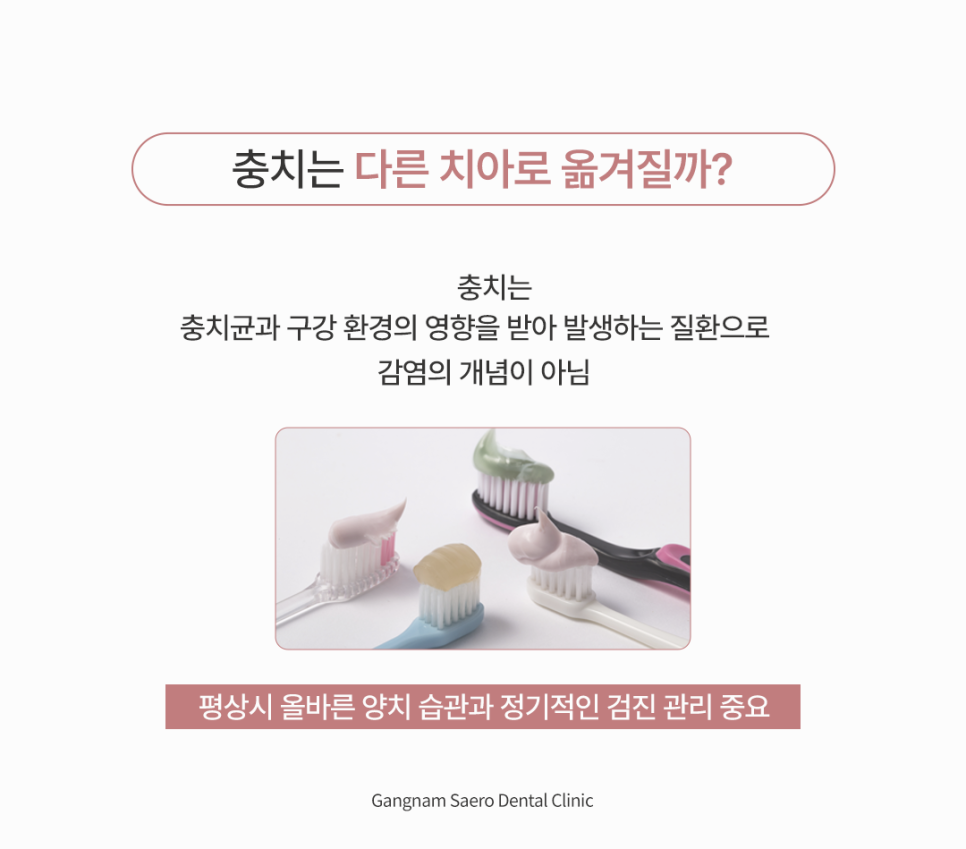 치과과잉진료 종류, 초기충치 인접면충치 충치옮음 시린이 제대로 알고 올바르게 치료하자 관련 이미지 4